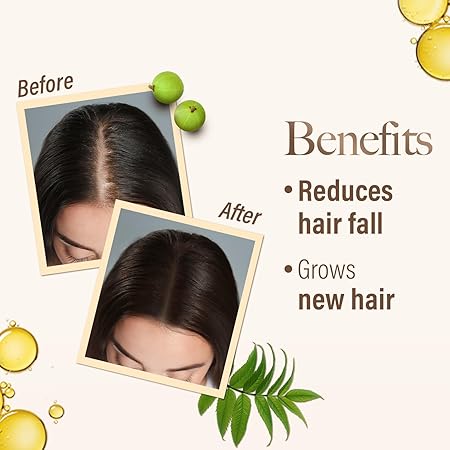 Kesh King Ayurvedic Scalp Oil – Herbal Hair Fall Control & Growth Booster