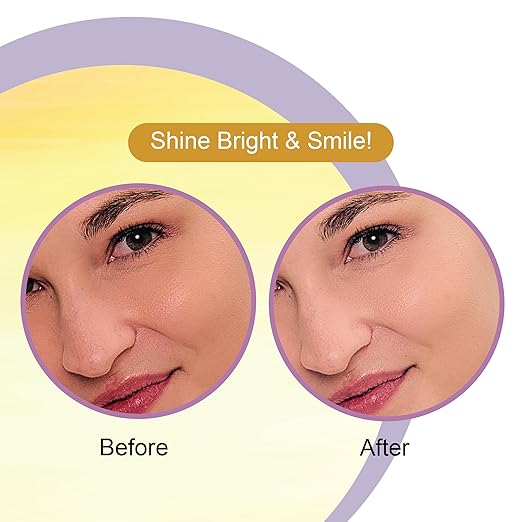Dr. Rashel Face Serum – Skin Brightening with Licorice & Niacinamide,