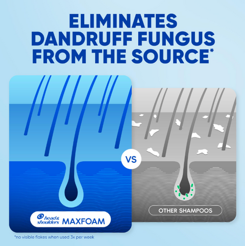 Head & Shoulders Dry Scalp Care Anti-Dandruff Shampoo With Almond Oil, 400 ml