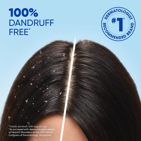 Head & Shoulders Dry Scalp Care Anti-Dandruff Shampoo With Almond Oil, 400 ml