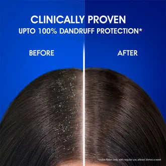 Head & Shoulders Anti Dandruff Cool Menthol Shampoo-400 ml